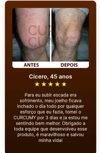 Curcumy- Sofre com dores ou inchaços? 706147