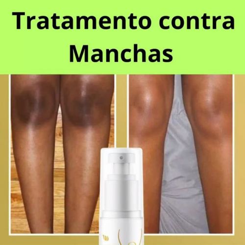 Nutralfit-quer Tratar as manchas De Uma Vez Por Todas? 723733